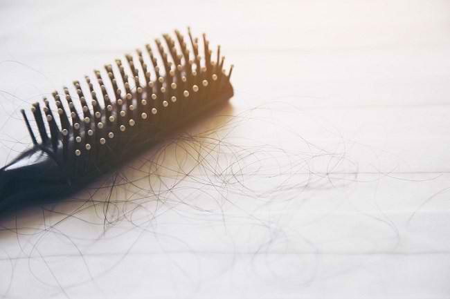 להלן 5 דרכים טבעיות להתגבר על נשירת שיער