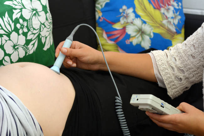 출생 장애를 예방하기 위한 태아 심박수 모니터링