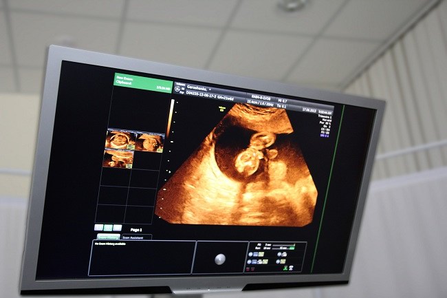 임신 2개월: 배아에서 태아까지