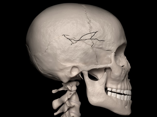 두개골 뼈의 부분과 기능 알기