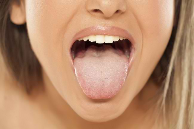 하얀 혀를 유발하는 4가지 조건 알아보기