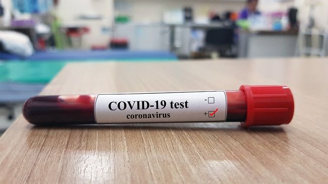 여기에서 긍정적인 COVID-19 신속 테스트에 대한 설명을 알아보세요