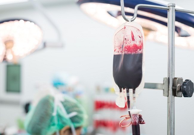 수혈의 다양한 이점과 위험
