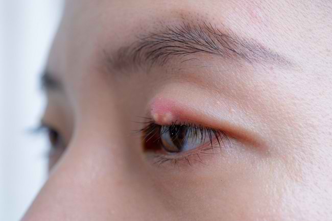 눈의 통증과 치료의 원인