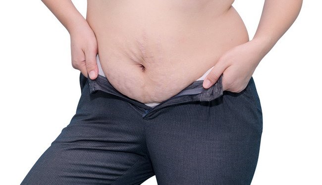 조심해, 이것들은 너무 뚱뚱할 때의 8가지 위험이다