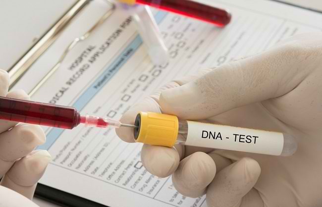 DNA 검사의 다양한 유형과 이점 알기
