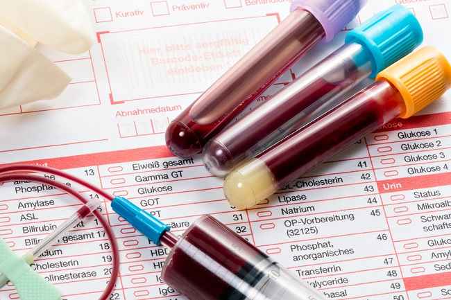 당뇨병 감지 및 조절을 위한 HbA1c 검사